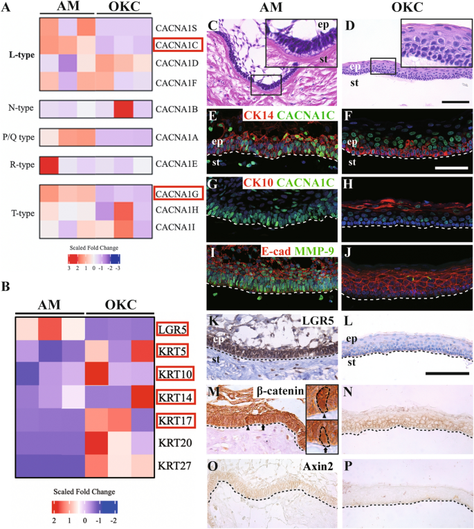 【文献解析】Cav1.2在成釉细胞瘤增殖及干细胞特性中的作用解析