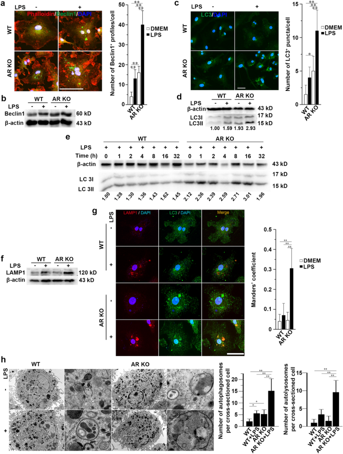 图3 AR缺失促进LPS诱导的巨噬细胞自噬体形成及成熟