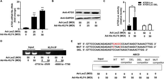 图4 KLF4直接转录激活ATG5表达