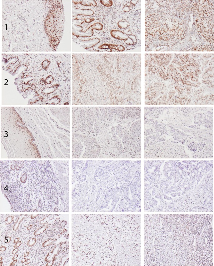 不同组织中RBM3免疫组化染色样本图