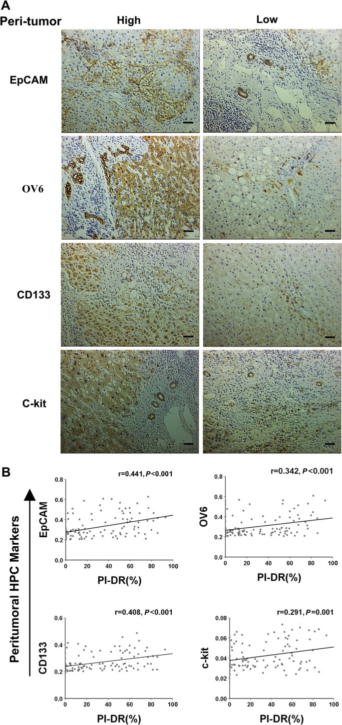 图2：PI-DR与癌旁HPC标志物的关联