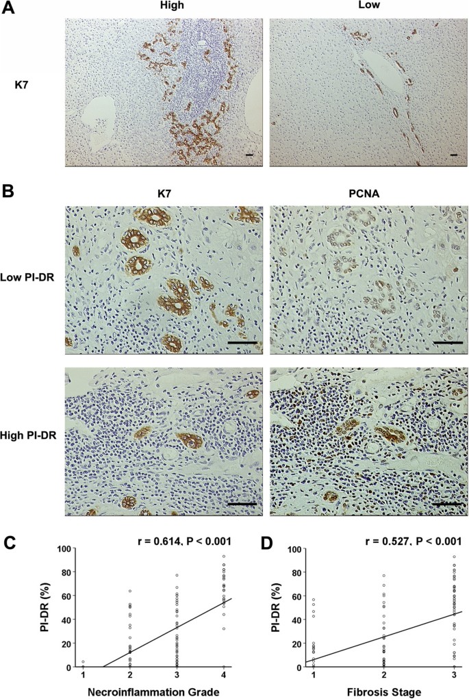 图1：PI-DR与炎症及纤维化的关联