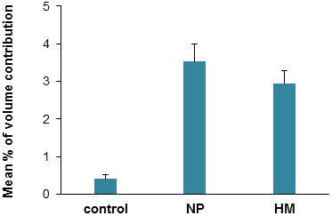 35 kDa ITIH4片段表达定量分析结果