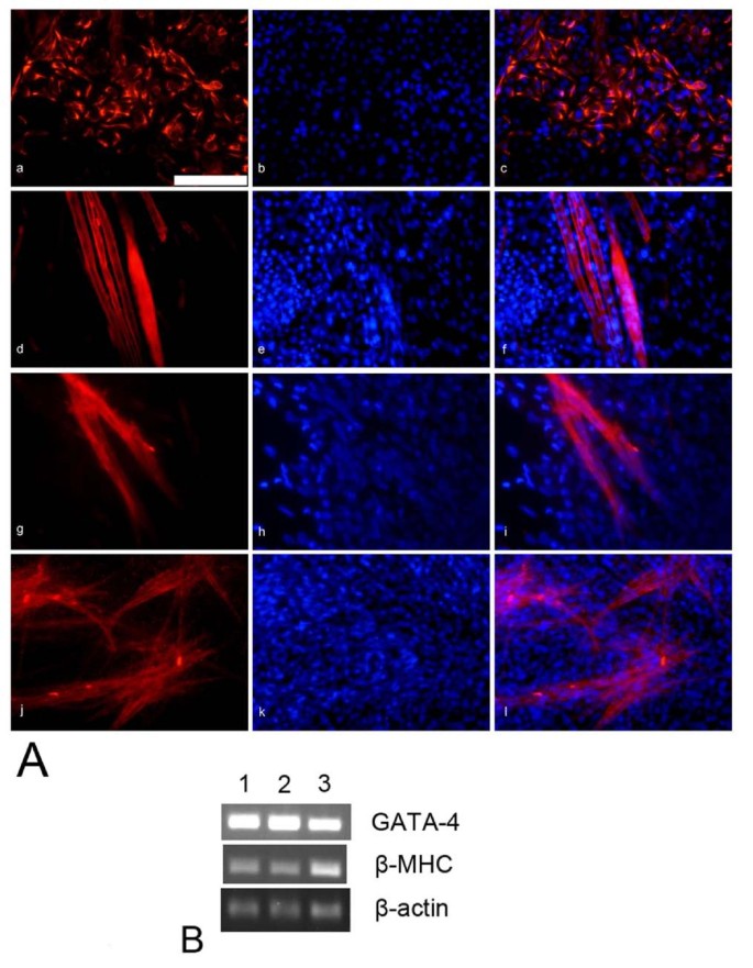 心肌细胞免疫荧光染色与基因表达
