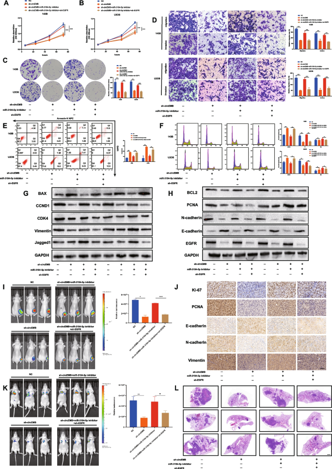 circEMB对骨肉瘤体内生长与转移的调控