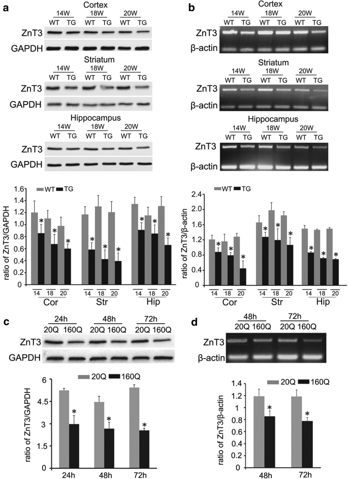 图4 转基因小鼠及160Q细胞中ZnT3的蛋白质免疫印迹与逆转录聚合酶链反应检测结果