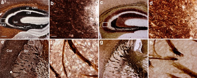 图1 转基因小鼠脑内突触囊泡锌的光镜AMG染色结果