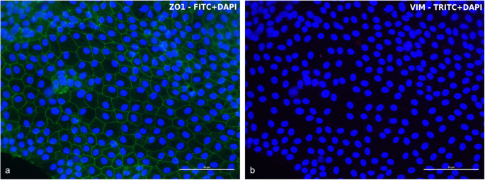 图9 cIECs紧密连接蛋白1与波形蛋白双标免疫荧光