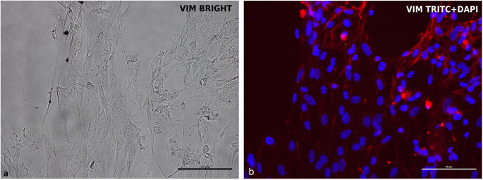 图2 鸡胚内皮细胞波形蛋白免疫荧光染色