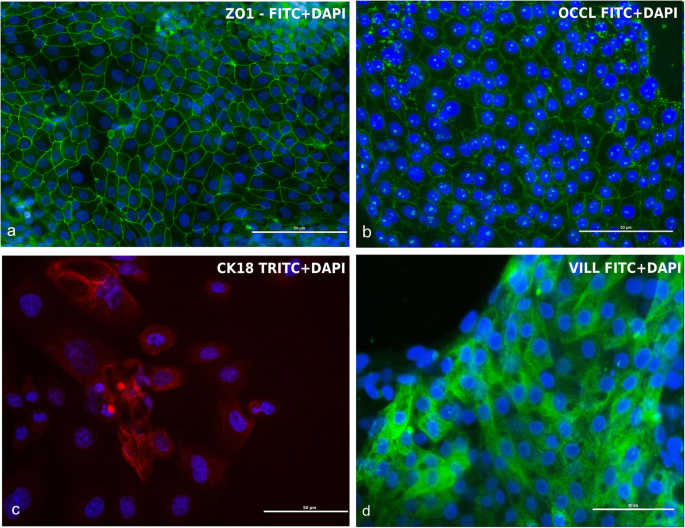 图7 cIECs上皮标记物免疫荧光染色