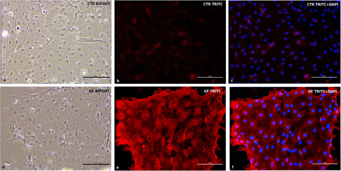图10 c-Myc蛋白免疫荧光染色