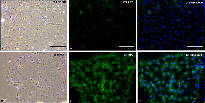 图11 MAPK1蛋白免疫荧光染色