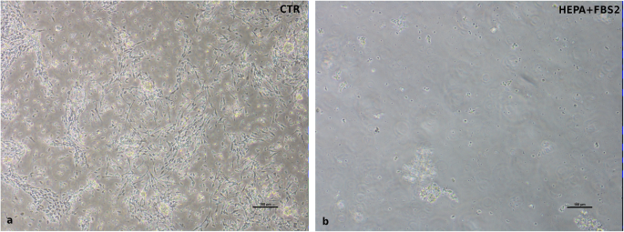 图3 不同培养基对污染细胞的抑制效果