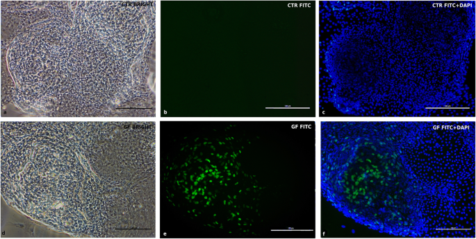 图8 EdU检测cIECs增殖活性