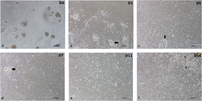 图1 不同培养时间点的cIECs形态