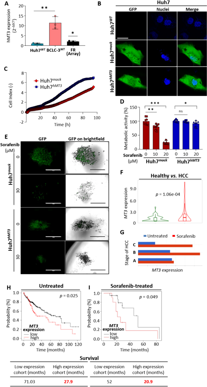 图2 hMT3过表达诱导肝癌细胞索拉非尼耐药及临床预后分析
