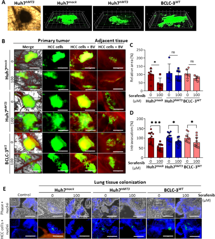 图4 ex ovo CAM模型验证hMT3诱导肝癌细胞索拉非尼耐药及转移