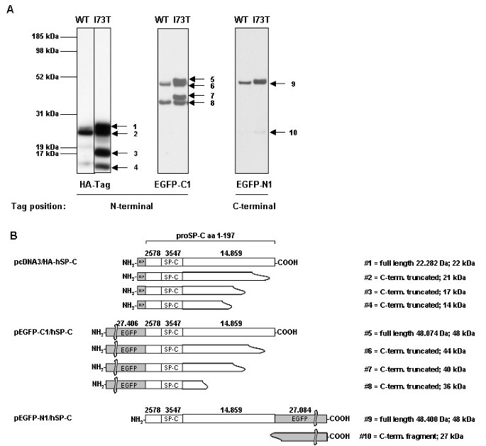 【文献解析】非BRICHOS结构域肺表面活性蛋白C突变破坏上皮细胞功能与细胞间信号传导