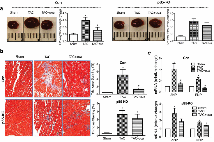 图7 哇巴因对TAC小鼠心脏重量、纤维化及肥厚标志物的影响