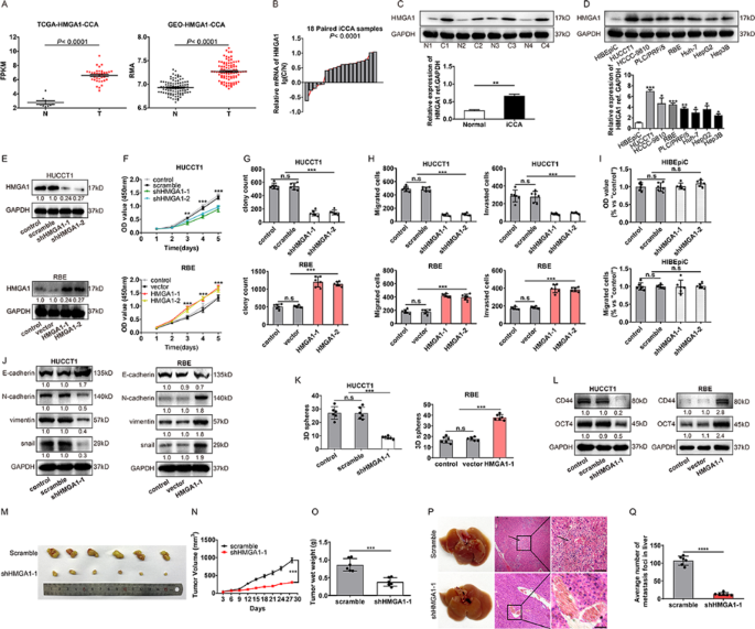 Fig.1 HMGA1在iCCA中的致癌功能验证