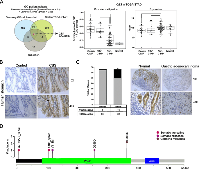 图2 胃癌临床样本中CBS表观突变与CIMP的关联