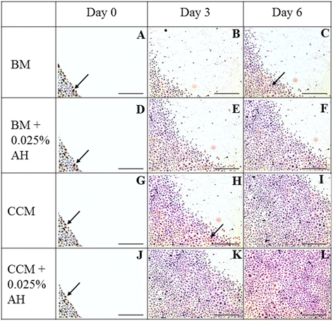 纤连蛋白蛋白免疫细胞化学染色图