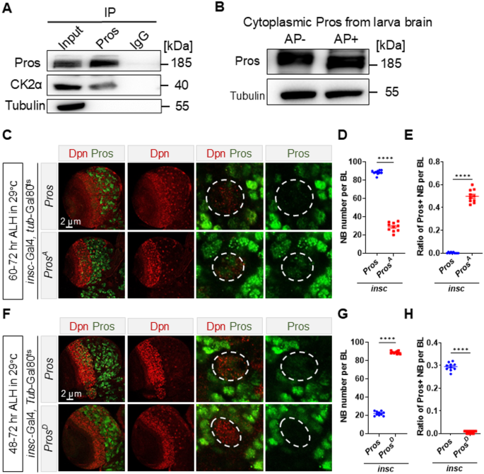 图6 酪蛋白激酶2通过磷酸化普罗斯佩罗蛋白调控其亚细胞定位
