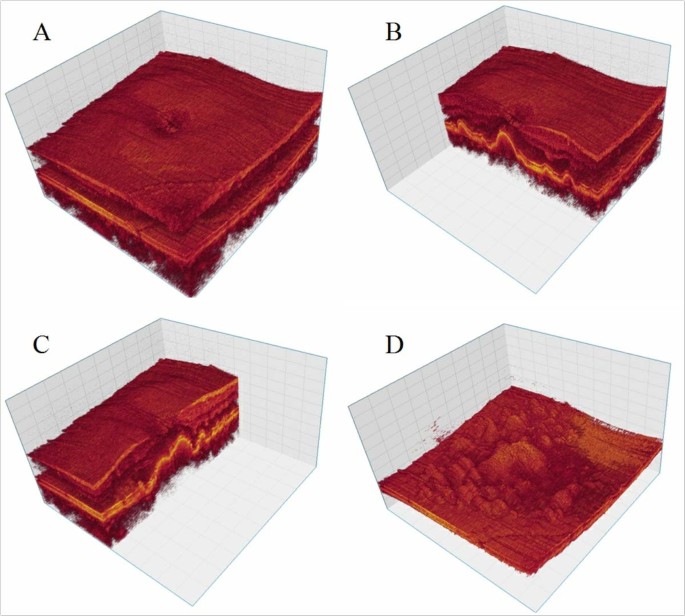 Figure 7：视网膜光学相干断层扫描数据的3D可视化，通过剪切平面展示内部结构