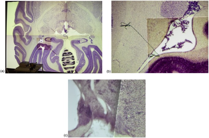 Figure 3：猴脑冷冻切片图像的高分辨率可视化，foveal inset区域分辨率显著高于周围