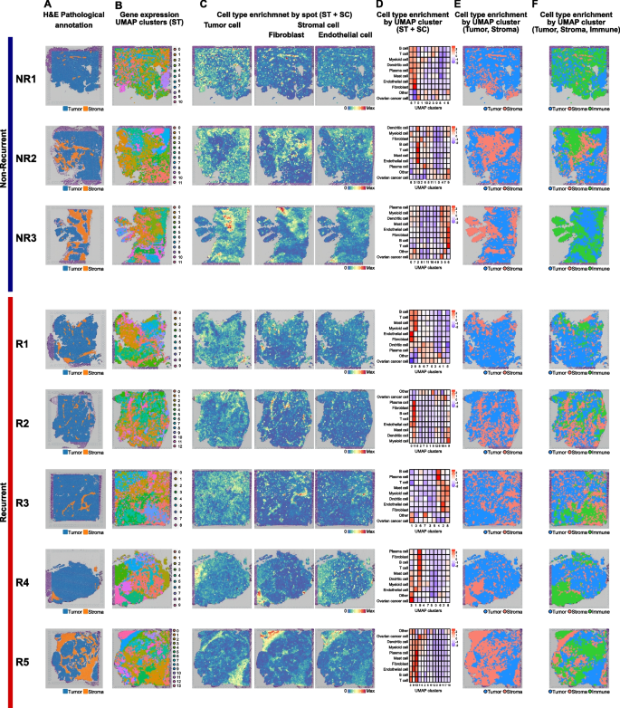Fig.1 HGSOC空间转录组特征分析