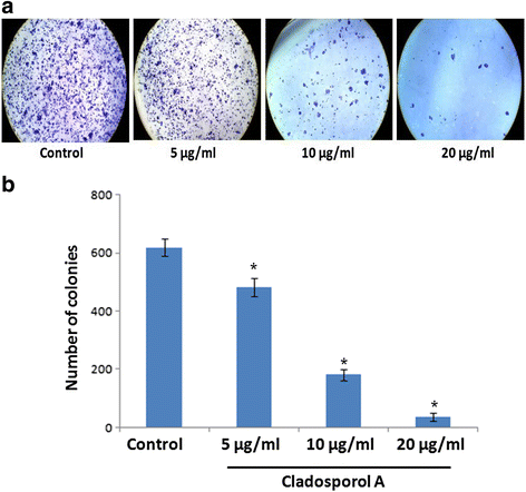 图4 Cladosporol A对MCF-7细胞克隆形成能力的影响