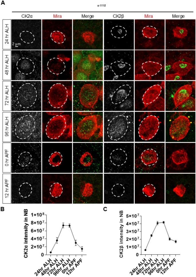 图3 酪蛋白激酶2在成神经细胞中的表达呈发育阶段依赖性动态变化