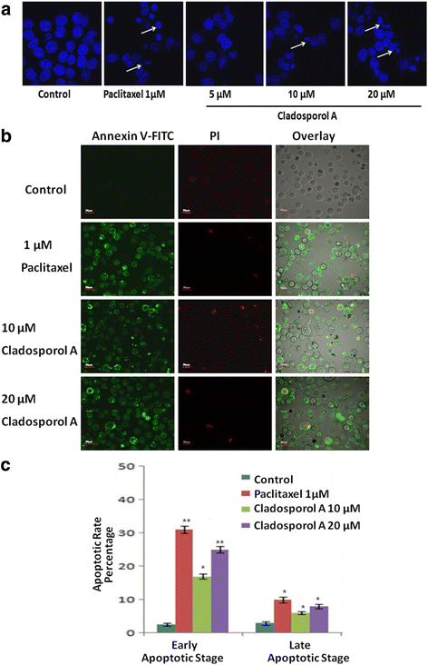 图6 Cladosporol A诱导MCF-7细胞凋亡的形态学与流式分析