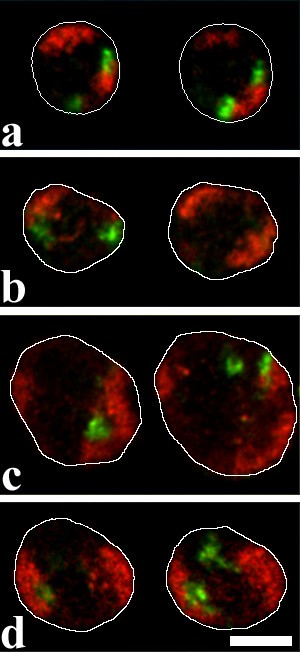 图3 染色体1和8涂染探针的3D荧光原位杂交结果