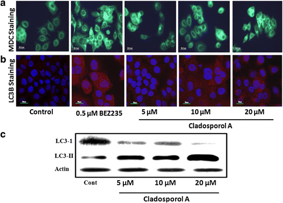 图11 Cladosporol A诱导MCF-7细胞自噬的检测