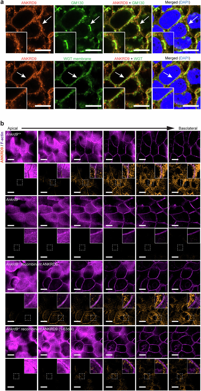 Fig. 4 ANKRD9亚细胞定位分析