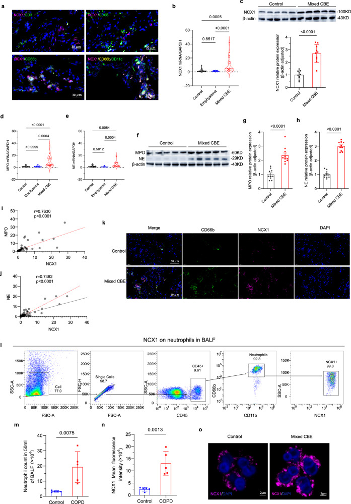 Fig. 1 临床样本中NCX1在中性粒细胞中的表达验证