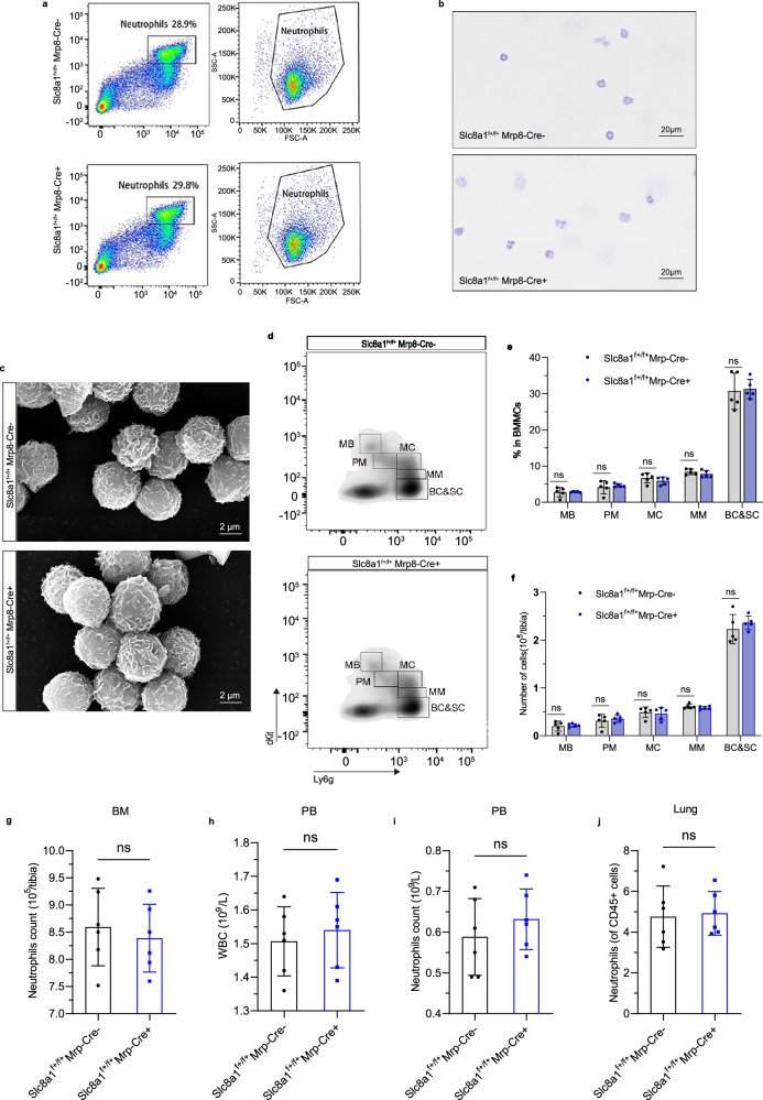Fig. 3 Slc8a1敲除对中性粒细胞发育与迁移的影响