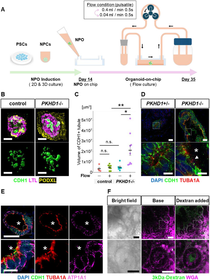 FIGURE 1 微流控类器官芯片模型复现ARPKD病理特征