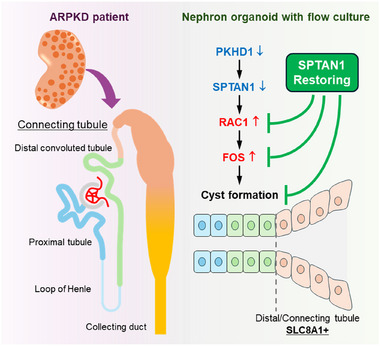 FIGURE 9 ARPKD囊性发生机制及SPTAN1治疗策略示意图