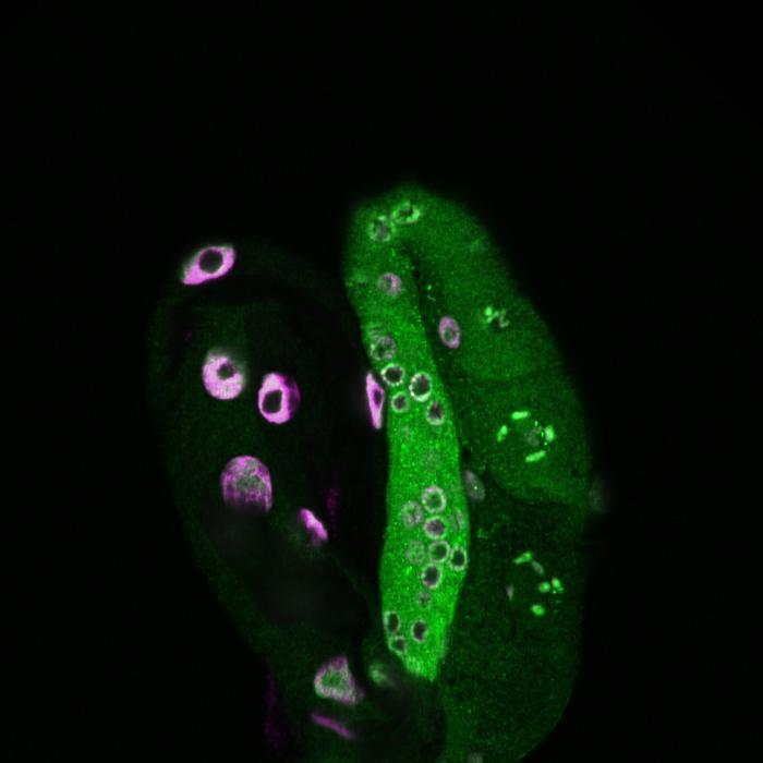 图中线虫左侧为肠道，右侧为生殖系。绿色显示组蛋白H3赖氨酸79的二甲基化标记，品红色标记为用DAPI染色的细胞核。图片来源：美国霍华德·休斯医学研究所