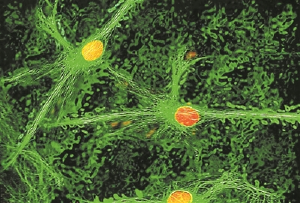 图中显示大脑旁臂核区域内与持续性疼痛相关的神经元。