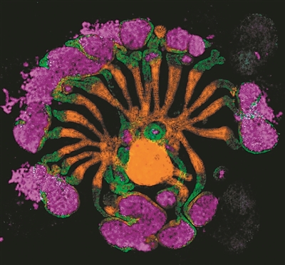实验室培育的人类肾脏“组合体”。图片来源：美国南加州大学