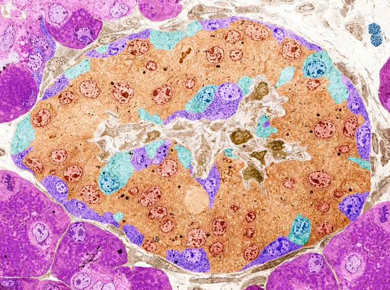 1型糖尿病患者的胰岛（人工染色）不再分泌足够的胰岛素。图片来源：Steve Gschmeissner/SP